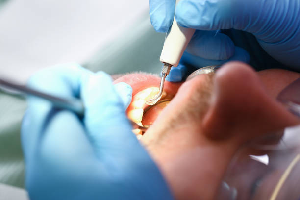 Best Emergency Tooth Extraction in North Charleroi, PA