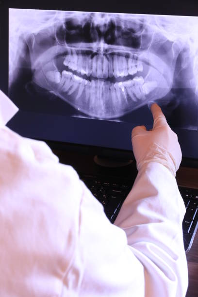 Best Emergency Tooth Extraction in North Charleroi, PA